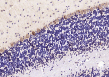 Dab1 Rabbit Polyclonal Antibody