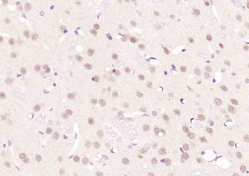 Smad3 Rabbit Polyclonal Antibody