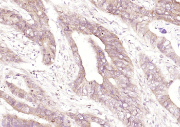 TOMM20 Rabbit Polyclonal Antibody