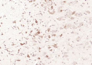 TOMM20 Rabbit Polyclonal Antibody