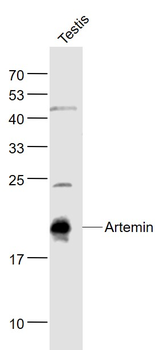 Artemin Rabbit Polyclonal Antibody