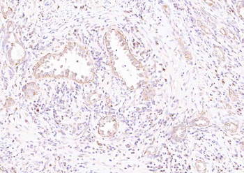 ULBP1 Rabbit Polyclonal Antibody