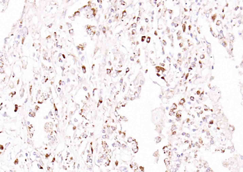 ULBP1 Rabbit Polyclonal Antibody