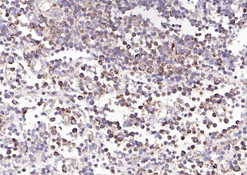 ULBP1 Rabbit Polyclonal Antibody