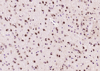 Phospho-MAPKAPK2 (Thr334) Rabbit Polyclonal Antibody