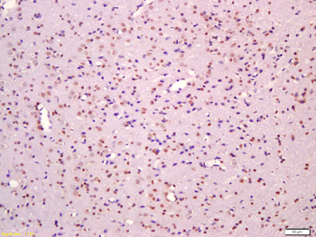 Phospho-MAPKAPK2 (Thr334) Rabbit Polyclonal Antibody