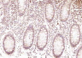 ErbB 4 Rabbit Polyclonal Antibody