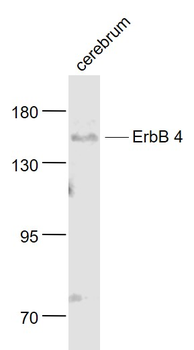 ErbB 4 Rabbit Polyclonal Antibody
