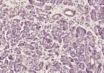 ErbB 4 Rabbit Polyclonal Antibody