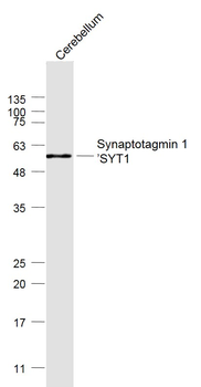 Synaptotagmin 1/SYT1 Rabbit Polyclonal Antibody
