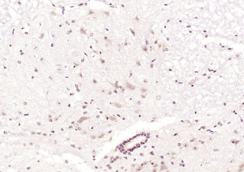CHRNB2 Rabbit Polyclonal Antibody