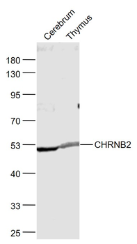 CHRNB2 Rabbit Polyclonal Antibody