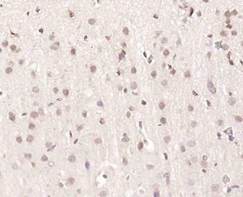 UBL7 Rabbit Polyclonal Antibody