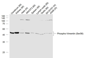 Phospho-Vimentin (Ser56) Rabbit Polyclonal Antibody