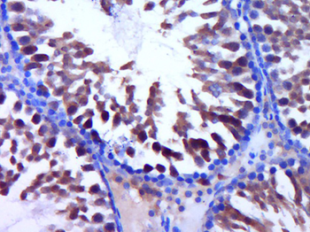 WNK1 Rabbit Polyclonal Antibody