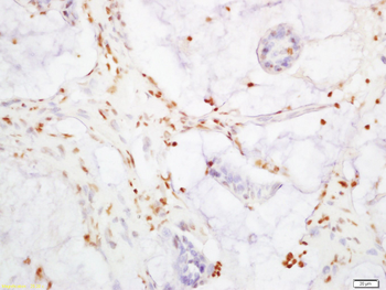 YAP1 Rabbit Polyclonal Antibody