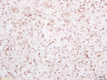 YAP1 Rabbit Polyclonal Antibody