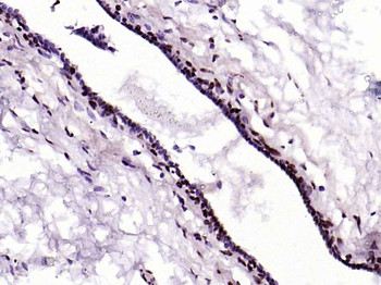 Phospho-YAP1 (Tyr407) Rabbit Polyclonal Antibody