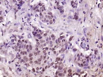 Phospho-YAP1 (Tyr407) Rabbit Polyclonal Antibody