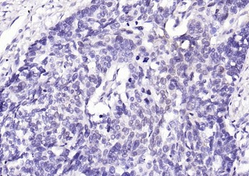 Phospho-YAP1 (Tyr407) Rabbit Polyclonal Antibody