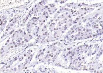 Phospho-YAP1 (Tyr407) Rabbit Polyclonal Antibody