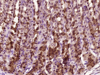 Phospho-YAP1 (Tyr407) Rabbit Polyclonal Antibody
