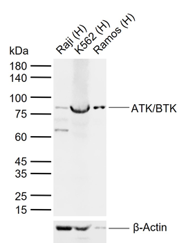 ATK/BTK Rabbit Polyclonal Antibody