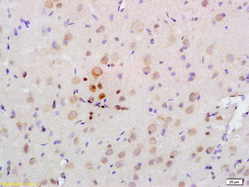 AMPK alpha 2 Rabbit Polyclonal Antibody