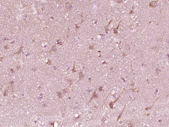 BMAL1 Rabbit Polyclonal Antibody