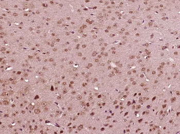 BMAL1 Rabbit Polyclonal Antibody