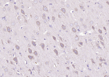 BMAL1 Rabbit Polyclonal Antibody