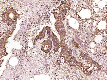 Phospho-arfaptin 2 (Ser260) Rabbit Polyclonal Antibody