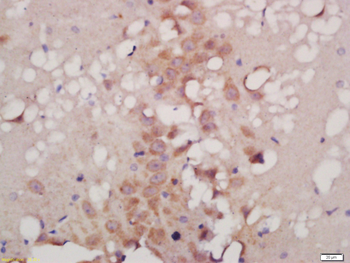 ATG9B Rabbit Polyclonal Antibody