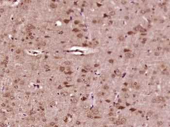 Phospho-BRAF (Ser365) Rabbit Polyclonal Antibody