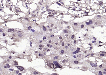 Phospho-BRAF (Ser365) Rabbit Polyclonal Antibody