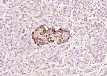 SMO Rabbit Polyclonal Antibody
