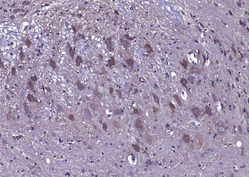 CACNA1G Rabbit Polyclonal Antibody