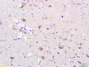 CACNA1G Rabbit Polyclonal Antibody