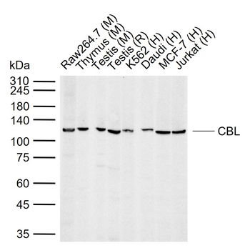 CBL Rabbit Polyclonal Antibody