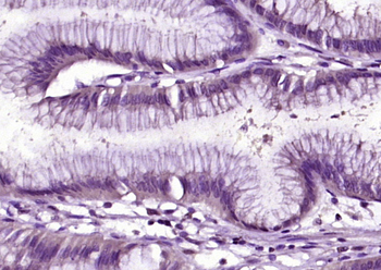 EPS8 Rabbit Polyclonal Antibody