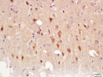 ADCY8 Rabbit Polyclonal Antibody