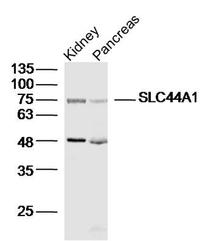 SLC44A1 Rabbit Polyclonal Antibody