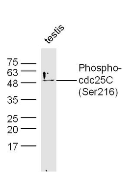 Phospho-cdc25C (Ser216) Rabbit Polyclonal Antibody