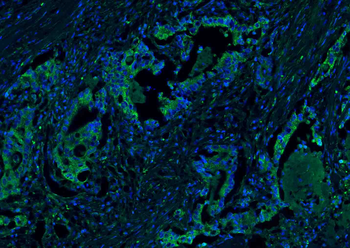 CEA Rabbit Polyclonal Antibody