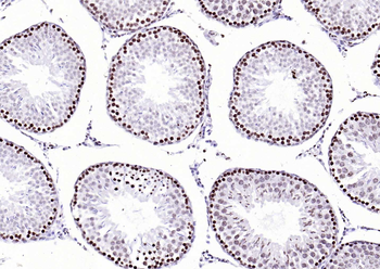 CENPA Rabbit Polyclonal Antibody