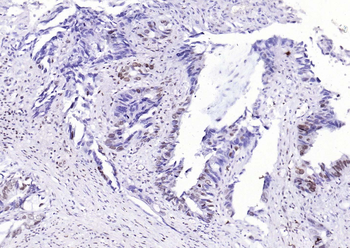 CENPA Rabbit Polyclonal Antibody
