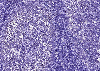 CENPA Rabbit Polyclonal Antibody