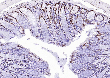 CENPA Rabbit Polyclonal Antibody