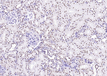 CENPA Rabbit Polyclonal Antibody