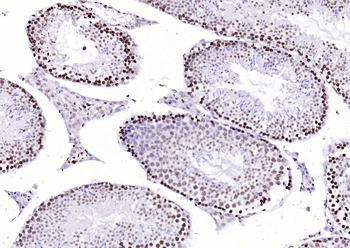 CENPA Rabbit Polyclonal Antibody